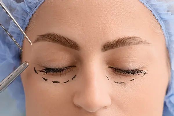 Avaliação pré-operatória de cirurgia plástica ocular nas pálpebras